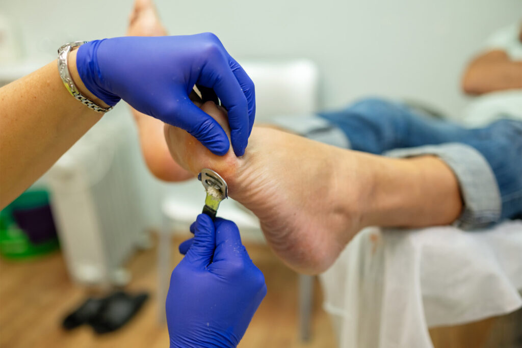 pedicure in arnhem-noord alteveer cranevelt medi pedi zorg